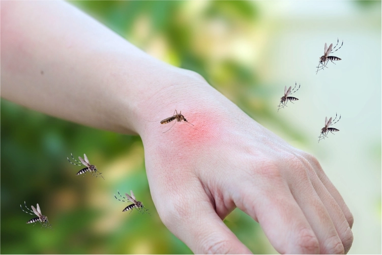 Malaria Malaria