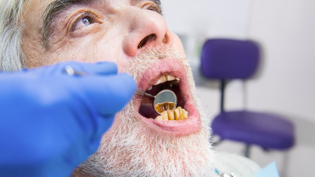 Why Teeth Turn Yellow With Age And How To Reverse it Restore Your Smile Now!